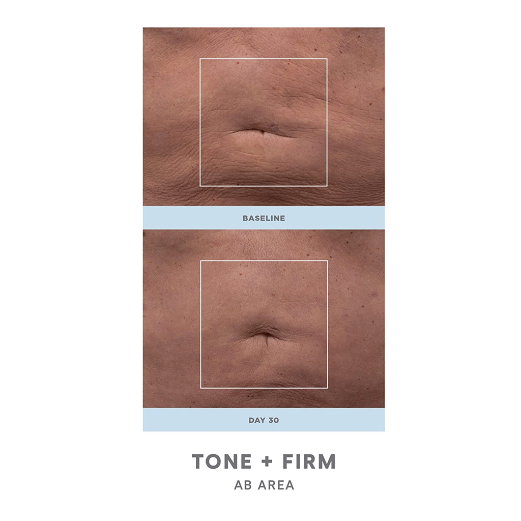 NuFACE - NuBODY SKIN Toning Device (296ml Aqua Gel)