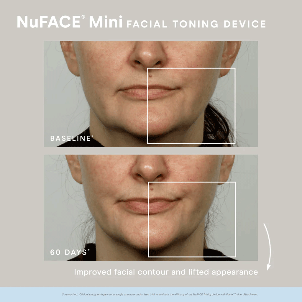 NuFACE - MINI KIT (includes Hydrating Aqua Gel 1.69 oz)